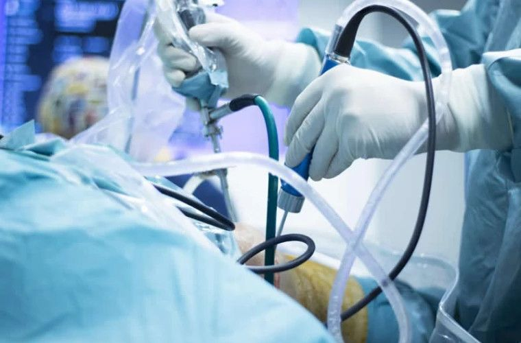 Выдающееся достижение: команда молдавских врачей реплантировала ампутированную руку пациенту